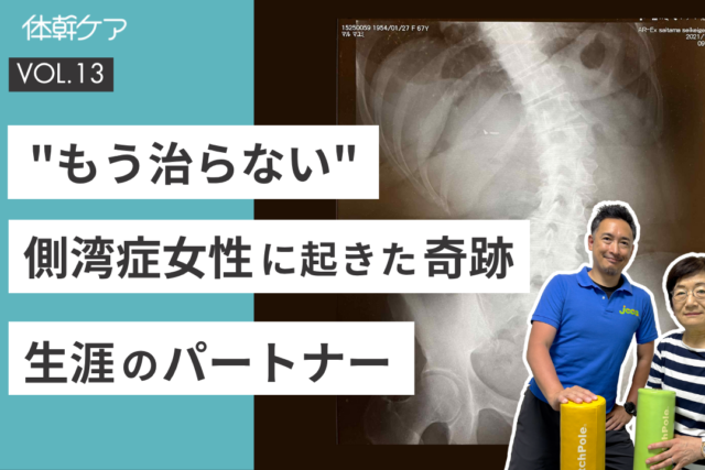 【体幹ケアインタビュー】「もう治らないと思った」脊柱側弯症の女性に起こった奇跡
