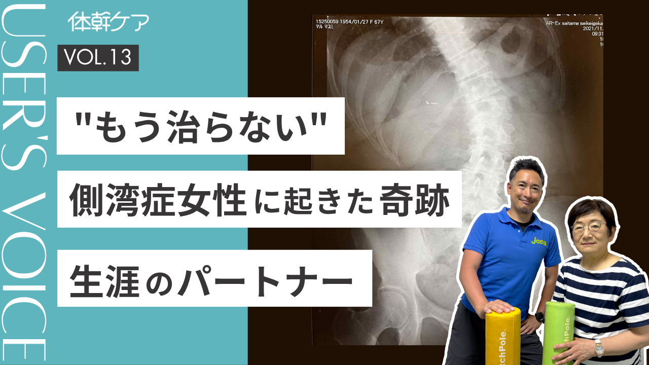 【体幹ケアインタビュー】「もう治らないと思った」脊柱側弯症の女性に起こった奇跡